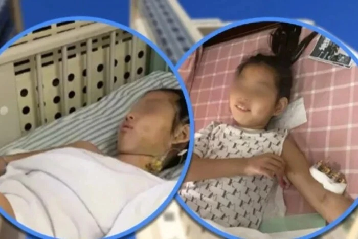 The girl survived after falling from a height